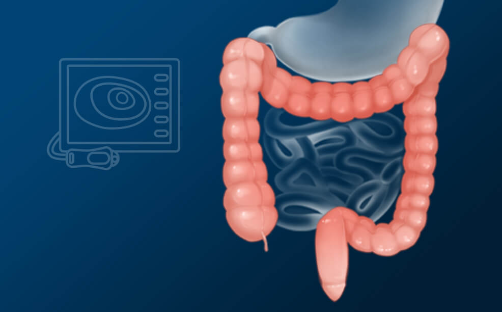 대장 내시경 검사